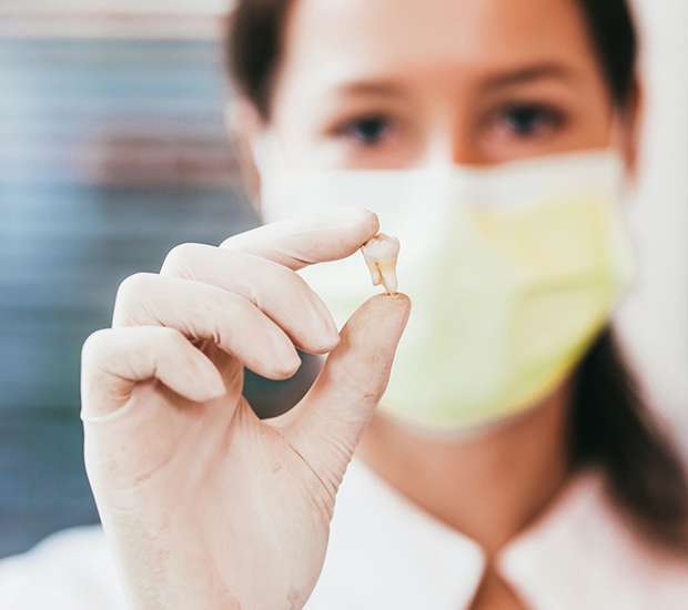 Newport Beach Tooth Extraction